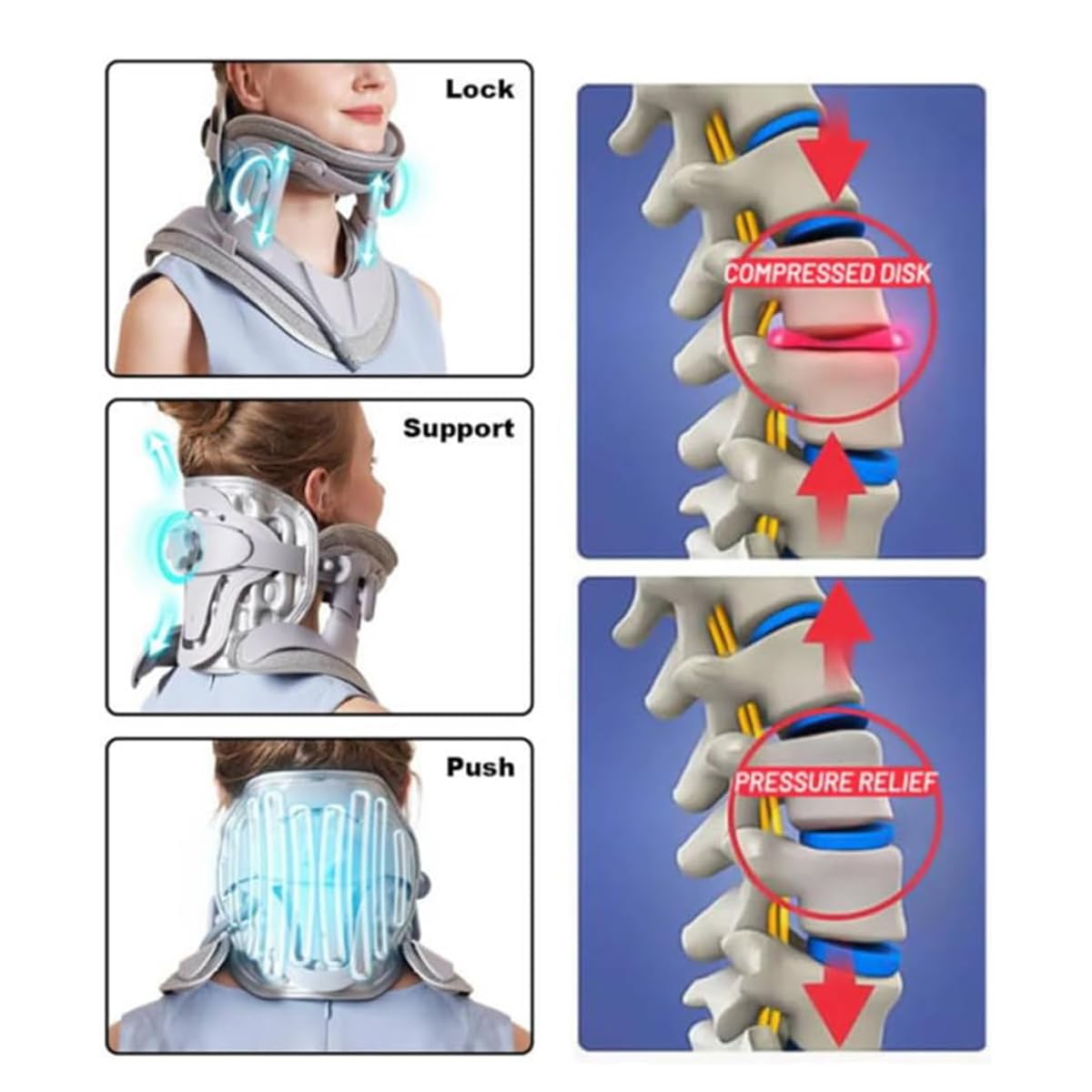 Cervical Neck Stretcher with 8 Airbags & Triple Traction